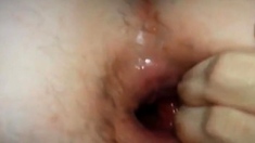 Twink's Extreme Anal Fisting Gape